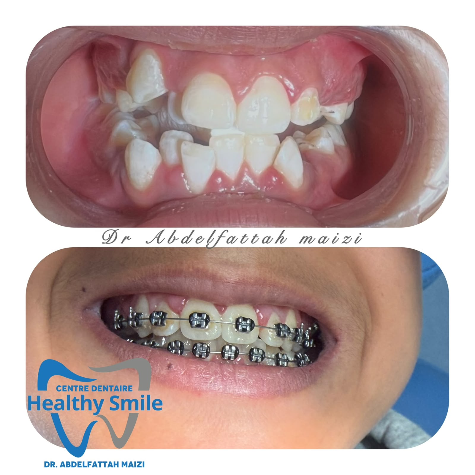 Soins esthétiques du sourire