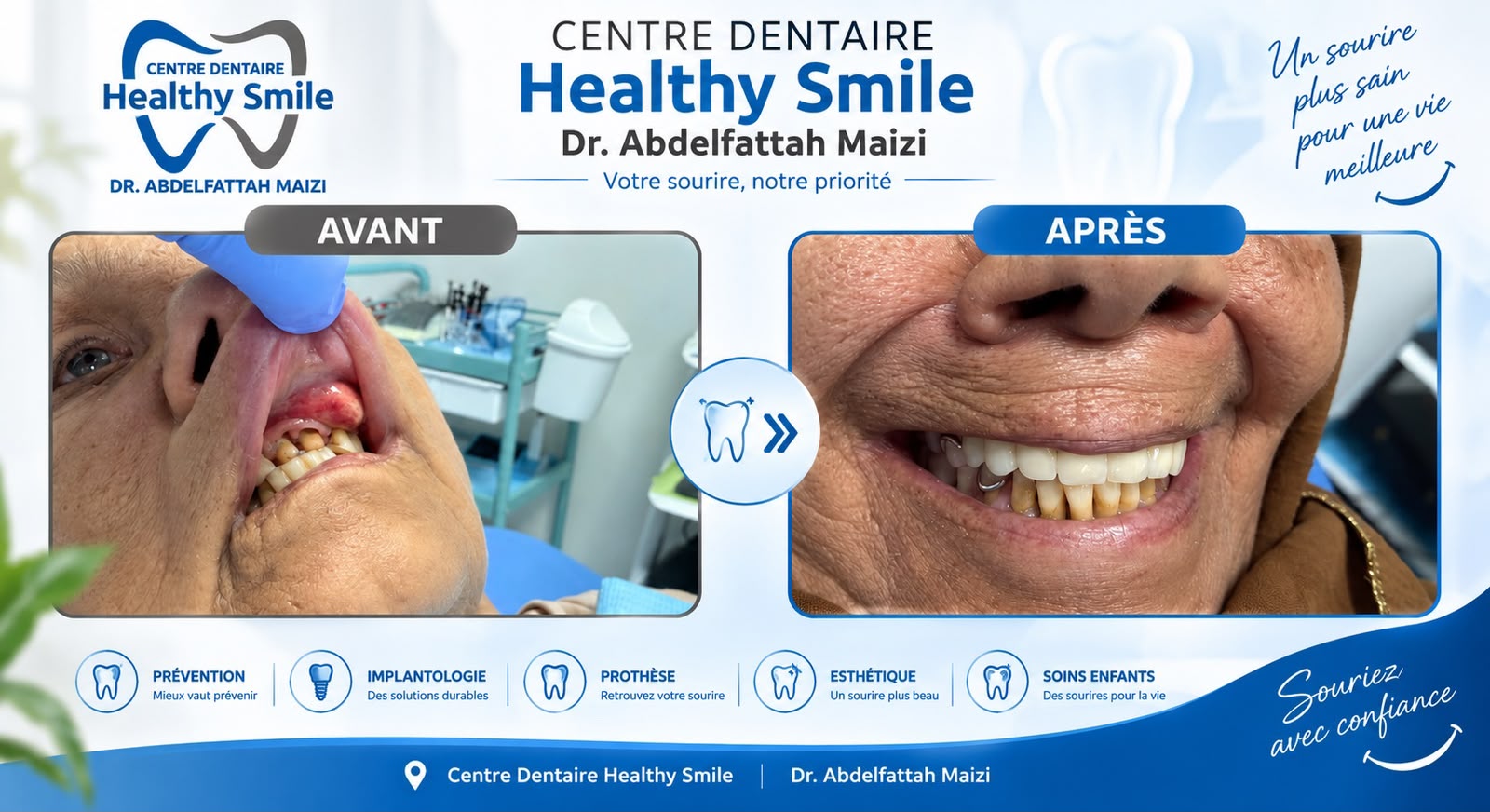 Transformation complète du sourire